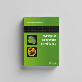 Arytmogenna kardiomiopatia prawej komory (kopia)